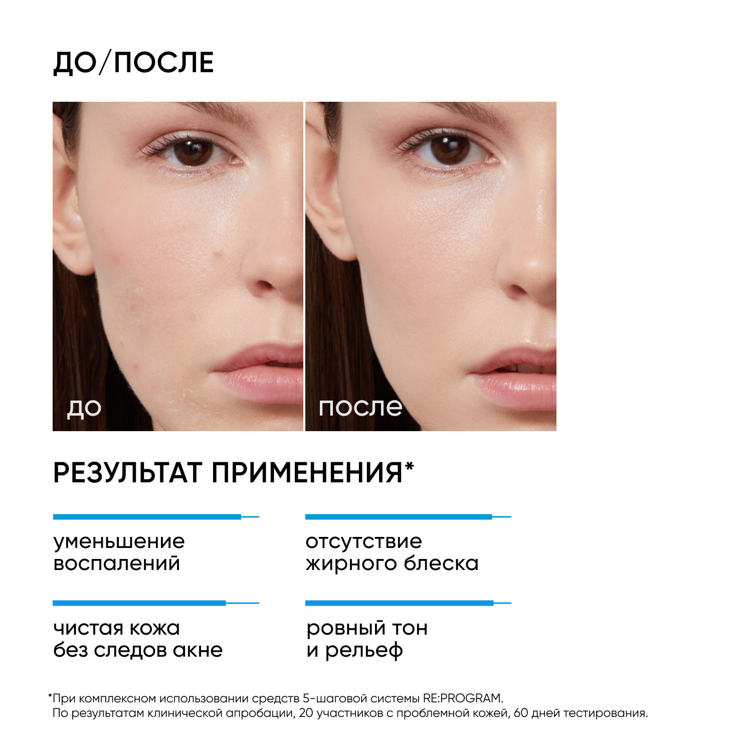 Айкон Скин Очищающая маска для проблемной кожи Wow Effect, 75 мл (Icon Skin, Re:Program) фото 1