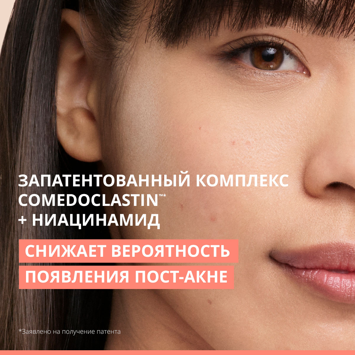 Авен Интенсивный концентрат для проблемной кожи, склонной к акне Comedomed 9+, 30 мл (Avene, Cleanance) фото 7