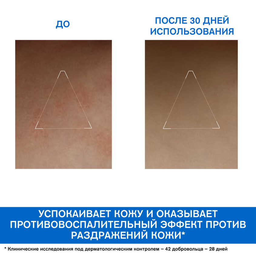 Урьяж Крем липидовосстанавливающий, 200 мл (Uriage, Xemose) фото 2