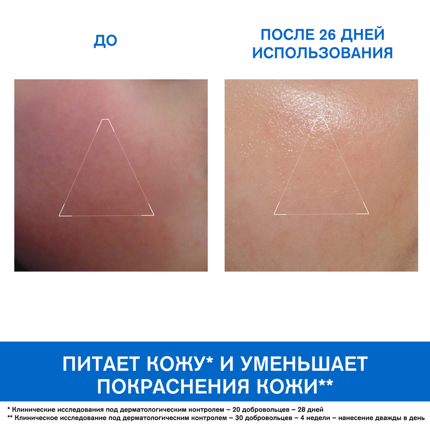 Урьяж Крем для лица, 40 мл (Uriage, Xemose) фото 2