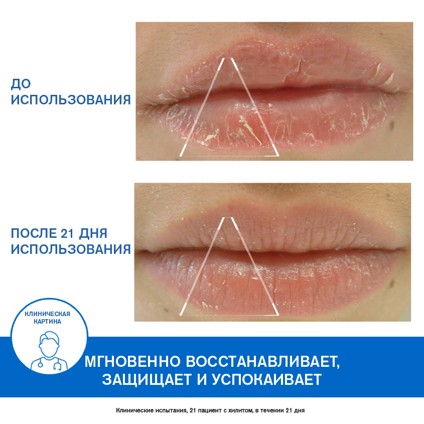 Урьяж Защищающий цика-бальзам для губ, 15 мл (Uriage, Bariederm) фото 2