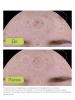 Адерма Крем для комплексного ухода за проблемной кожей AC Global, 40 мл (A-Derma, Biology) фото 5