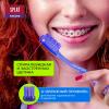 Сплат Ортодонтическая мягкая зубная щетка Smilex Ortho+ (Splat, Ortho) фото 3
