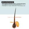 Лореаль Профессионель Зимний набор Scalp Advanced для чувствительной кожи головы: шампунь 300 мл + смываемый уход 200 мл (L'oreal Professionnel, Serie Expert) фото 10