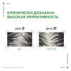 Виши Интенсивный шампунь-уход для сухих волос против перхоти DS - сменный блок (рефилл), 500 мл (Vichy, Dercos) фото 6