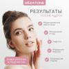 Жезатон Маска миостимулятор для лица Biolift iFace (Gezatone, Массажеры для лица) фото 10