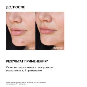 Icon Skin Точечное SOS-средство от воспалений, 20 мл. фото