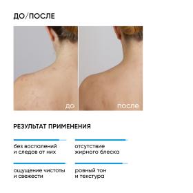 Icon Skin Противовоспалительный очищающий гель для лица и тела Blemish Control, 250 мл. фото