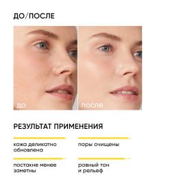 Icon Skin Очищающий гель для умывания с кислотами Soft Renew, 150 мл. фото