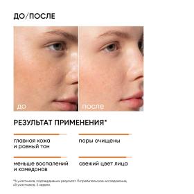 Icon Skin Отшелушивающий тоник с миндальной кислотой, 150 мл. фото