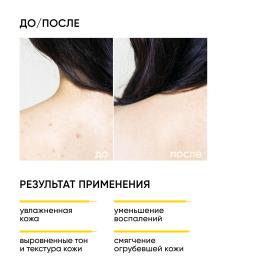 Icon Skin Обновляющий крем для тела с кислотами Skin Renewal, 200 мл. фото